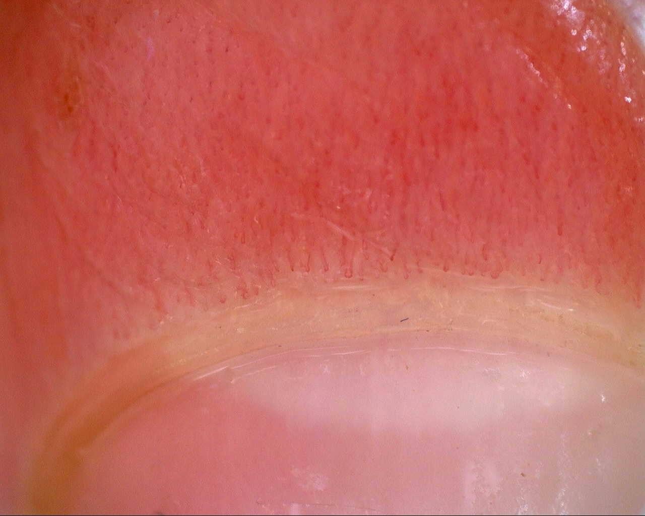 Preview image for Initial study