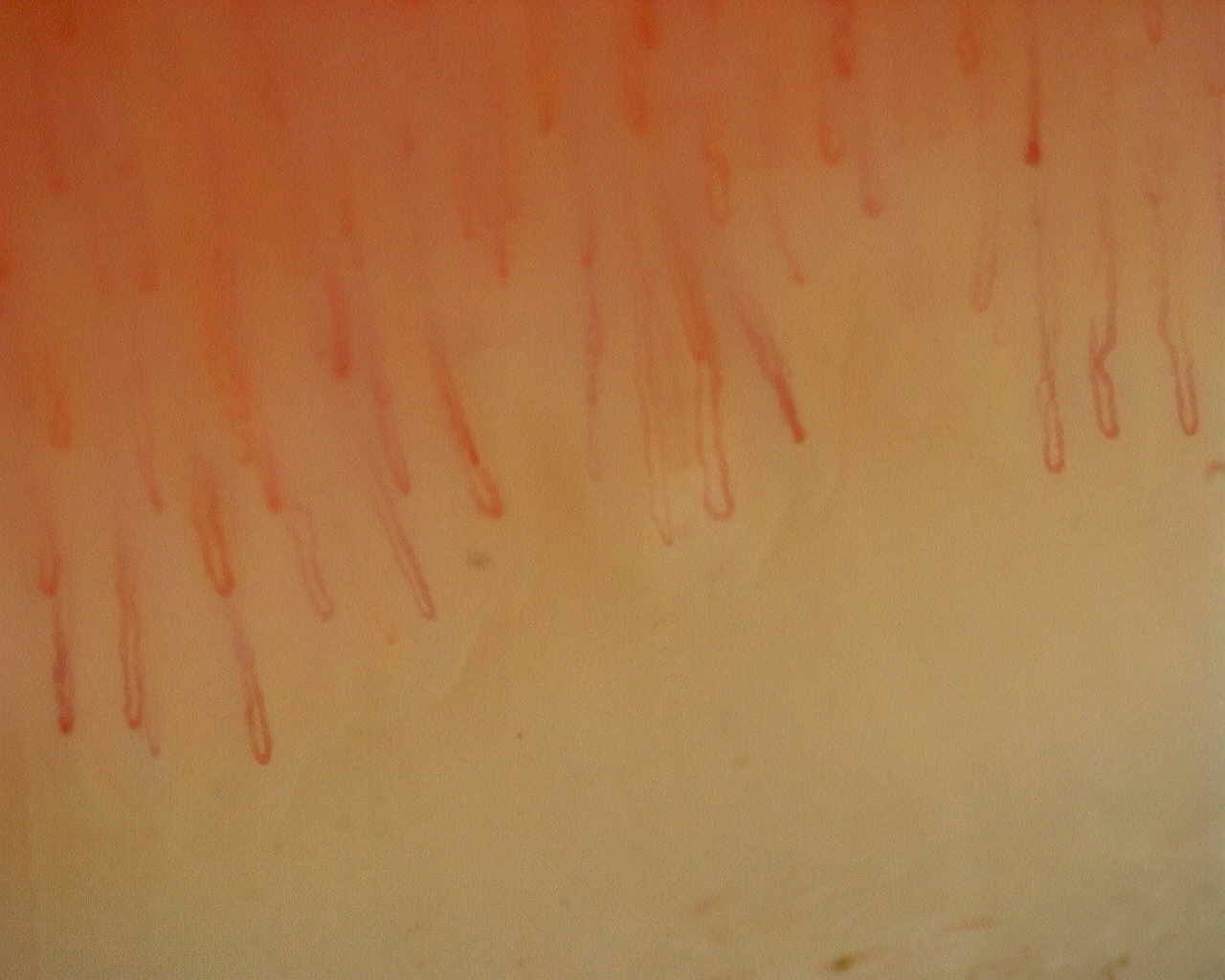 Preview image for Non-Specific Pattern: Representative Case