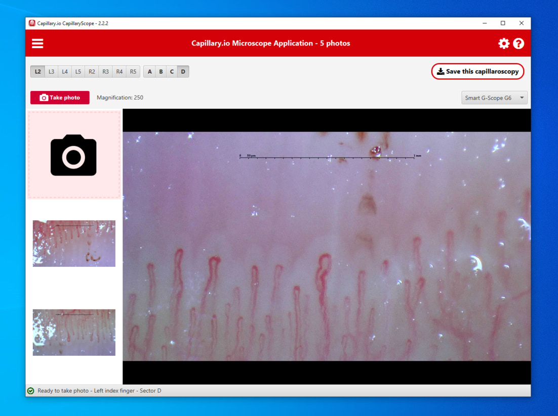 Guided image capture with CapillaryScope