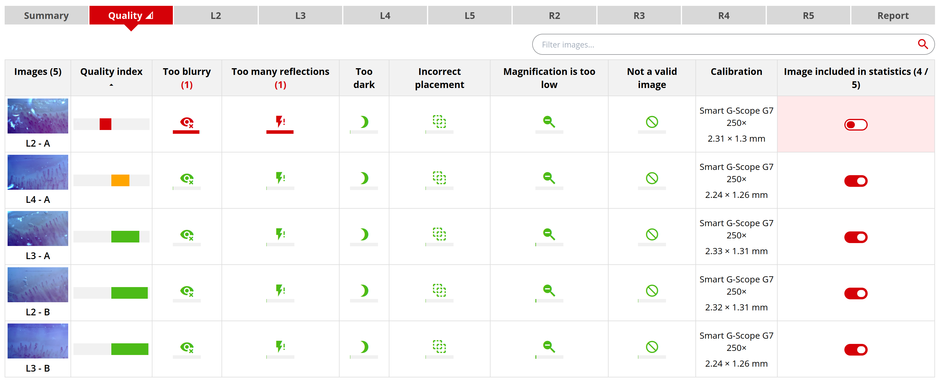 Quality-control output in Capillary.io