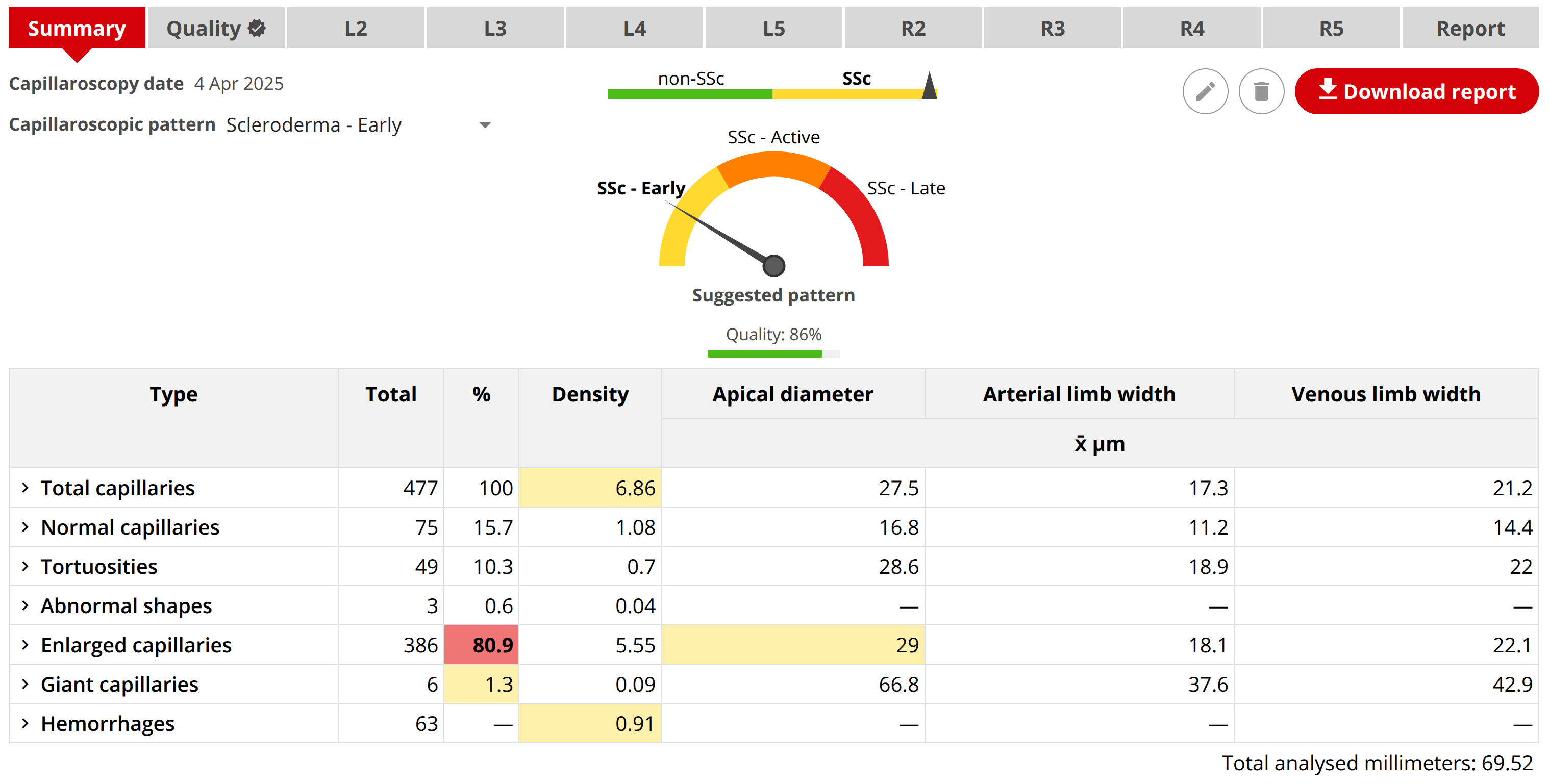 Immediate quantitative report in Capillary.io